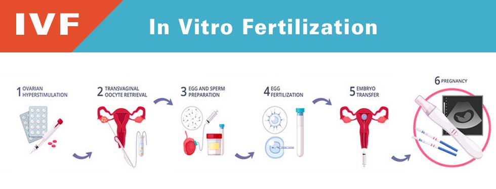 ivf process